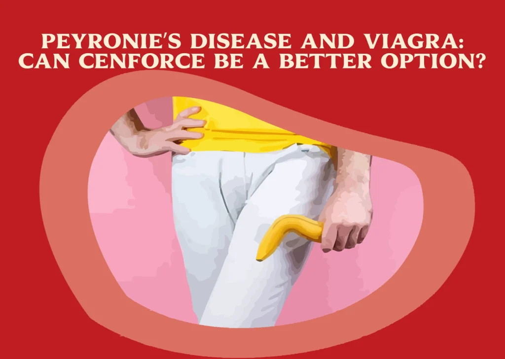 Peyronie’s Disease and Viagra- Can Cenforce Be a Better Option
