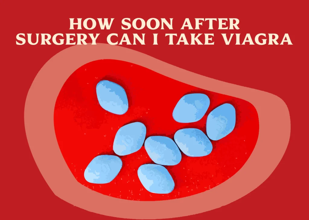 How Soon After Surgery Can I Take Viagra