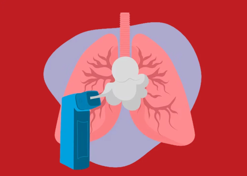 smart inhalers releasing medication mist into illustrated lungs representing the future of smart inhaler lung monitoring technology
