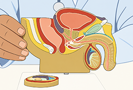 Men having Mediterranean Diet for ED